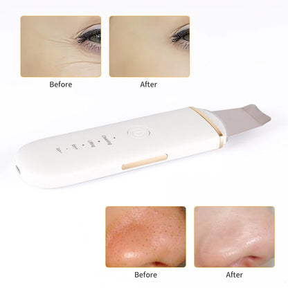 DermaPulse